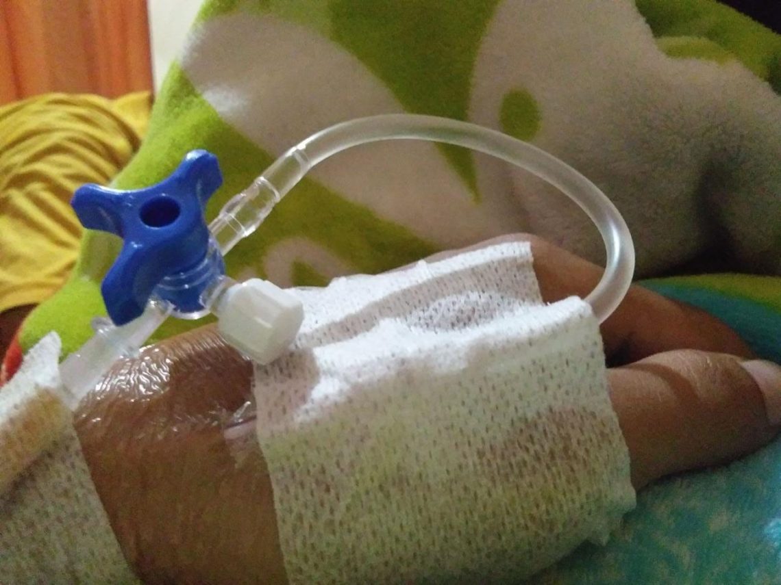 Menikmati Sakit di Libur yang Amat Sempit