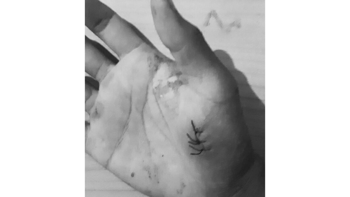 Sekepal Pelajaran Saat Luka Bercerita