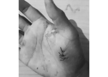 Sekepal Pelajaran Saat Luka Bercerita